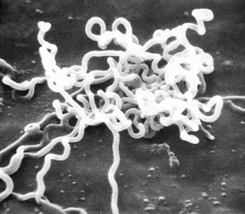 free sex therapy Treponema pallidum under electron microscope