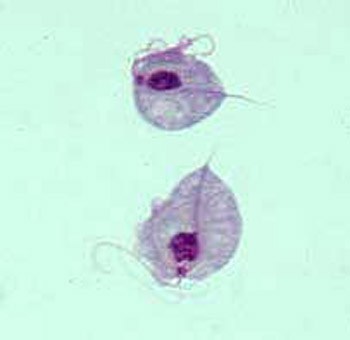 Sex therapy trichomoniasis under microscope